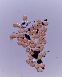 Attēlu rezultāti vaicājumam “Enteridium olivaceum spores”