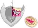 HeartPoint: Valvular Heart Disease: Tell me more