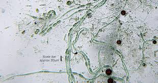 Attēlu rezultāti vaicājumam “Nostoc commune cells”