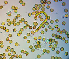 Attēlu rezultāti vaicājumam “Trichia longipalpis sessile”