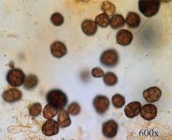 Attēlu rezultāti vaicājumam “Badhamia melanospora spores”