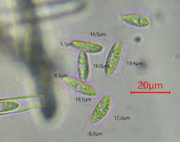 Attēlu rezultāti vaicājumam “Hymenoscyphus sp.”