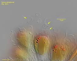 Attēlu rezultāti vaicājumam “Pohlia sphagnicola”