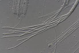 Attēlu rezultāti vaicājumam “Stictis”