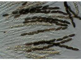 Attēlu rezultāti vaicājumam “Xylaria hypoxylon”