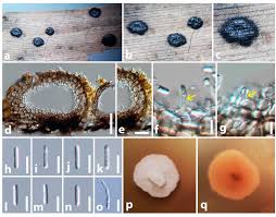 Attēlu rezultāti vaicājumam “Diachea dictyospora (syn. Craterium dictyosporum) spores”