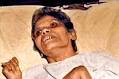 Aruna Shanbaug death: India not ready for mercy killing, say experts