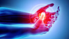 What are the signs of arthritis in the hands? - UChicago Medicine