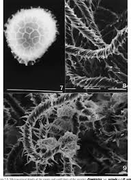 Attēlu rezultāti vaicājumam “Hemitrichia serpula spores”