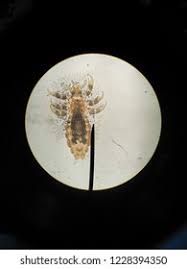 Attēlu rezultāti vaicājumam “Pediculus humanus capitis”