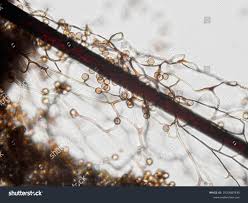 Attēlu rezultāti vaicājumam “Stemonitis pallida var. rubescens spores”