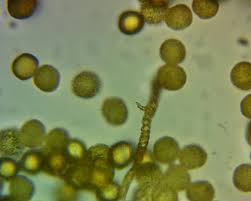 Attēlu rezultāti vaicājumam “Trichia contorta”