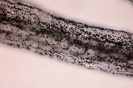 Attēlu rezultāti vaicājumam “Stemonitis lignicola spores”