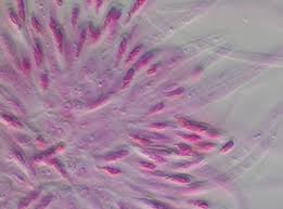 Attēlu rezultāti vaicājumam “Comatricha pulchella spores”