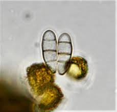 Attēlu rezultāti vaicājumam “Trichia scabra sessile”