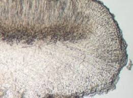 Attēlu rezultāti vaicājumam “Bacidia rubella”