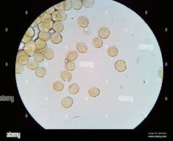 Attēlu rezultāti vaicājumam “Hemitrichia decipiens”