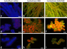 Attēlu rezultāti vaicājumam “Trentepohlia sp.”