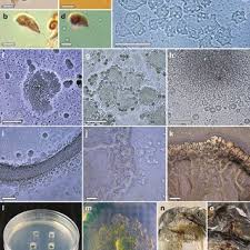 Attēlu rezultāti vaicājumam “Fuligo septica var. candida spores”