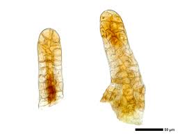 Attēlu rezultāti vaicājumam “Leiocolea rutheana”