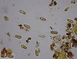 Attēlu rezultāti vaicājumam “Arthonia vinosa”