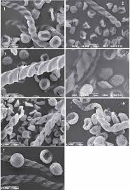 Attēlu rezultāti vaicājumam “Cephalozia loitlesbergeri”