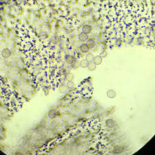 Attēlu rezultāti vaicājumam “Cribraria violacea”