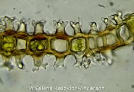 Attēlu rezultāti vaicājumam “Heterotrichia oerstedii (syn. Arcyria oerstedii) stalked”