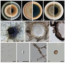 Attēlu rezultāti vaicājumam “Stemonitopsis aequalis var. microspora spores”