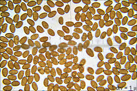 Attēlu rezultāti vaicājumam “Cribraria oregana spores”