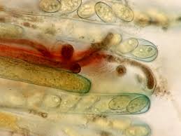 Attēlu rezultāti vaicājumam “Sowerbyella radiculata”