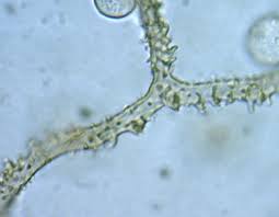 Attēlu rezultāti vaicājumam “Arcyria affinis stalked”