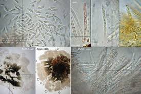 Attēlu rezultāti vaicājumam “Mollisia cinerea”