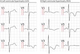 Image result for  ^ L V [ h    