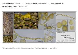 Attēlu rezultāti vaicājumam “Perichaena corticalis spores”