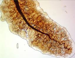 Attēlu rezultāti vaicājumam “Stemonitopsis gracilis”
