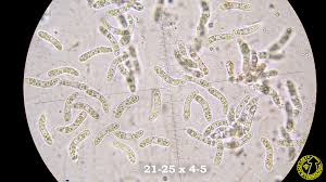 Attēlu rezultāti vaicājumam “Ruzenia spermoides”