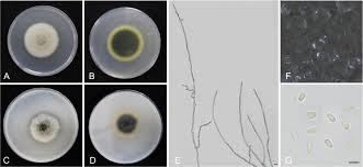 Attēlu rezultāti vaicājumam “Diderma umbilicatum spores”