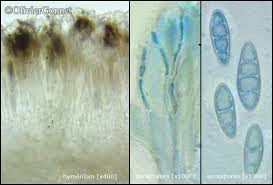 Attēlu rezultāti vaicājumam “Bilimbia tetramera”