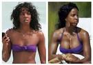 Breast Augmentation Surgery—Most Popular Cosmetic Procedure in ...