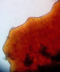 Attēlu rezultāti vaicājumam “Lycogala ustulatum sessile”