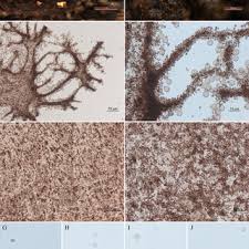 Attēlu rezultāti vaicājumam “Lycogala succineum”