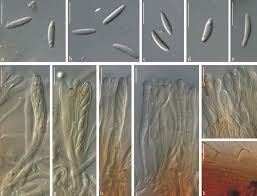 Attēlu rezultāti vaicājumam “Heyderia pusilla”