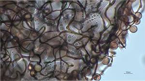 Attēlu rezultāti vaicājumam “Comatricha nigra spores”