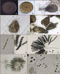 Attēlu rezultāti vaicājumam “Sordaria fimicola”
