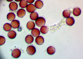Attēlu rezultāti vaicājumam “Lycogala ustulatum”
