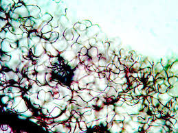 Attēlu rezultāti vaicājumam “Stemonitopsis subcaespitosa”