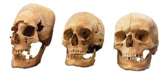 Image result for elongated skulls