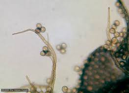 Attēlu rezultāti vaicājumam “Trichia scabra spores”