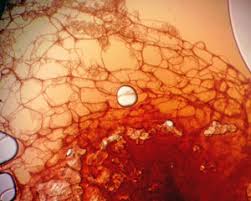 Attēlu rezultāti vaicājumam “Cribraria rubiginosa spores”